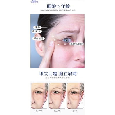 宜昌市_美容院玻尿酸微针眼贴